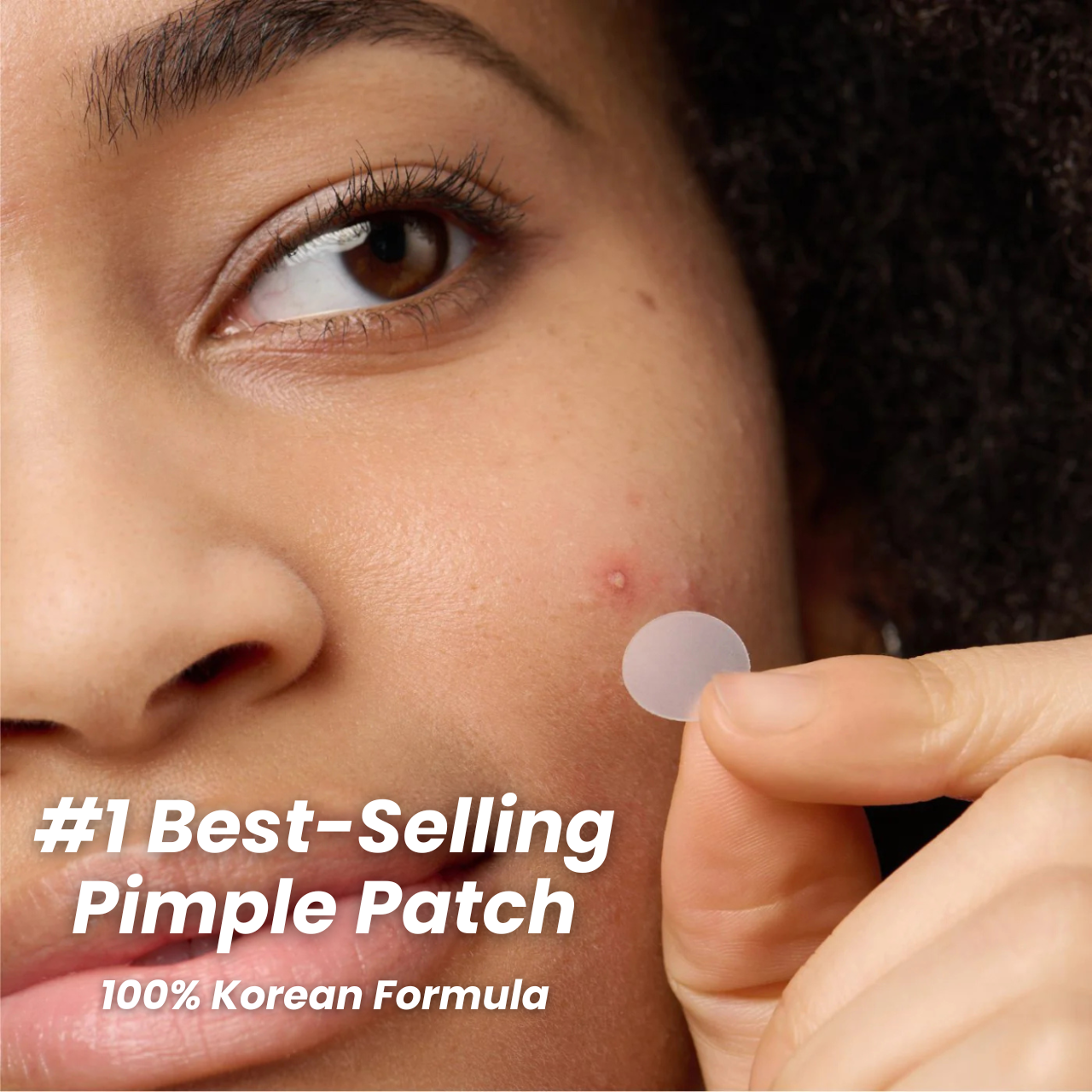 Miracle Pimple Patch