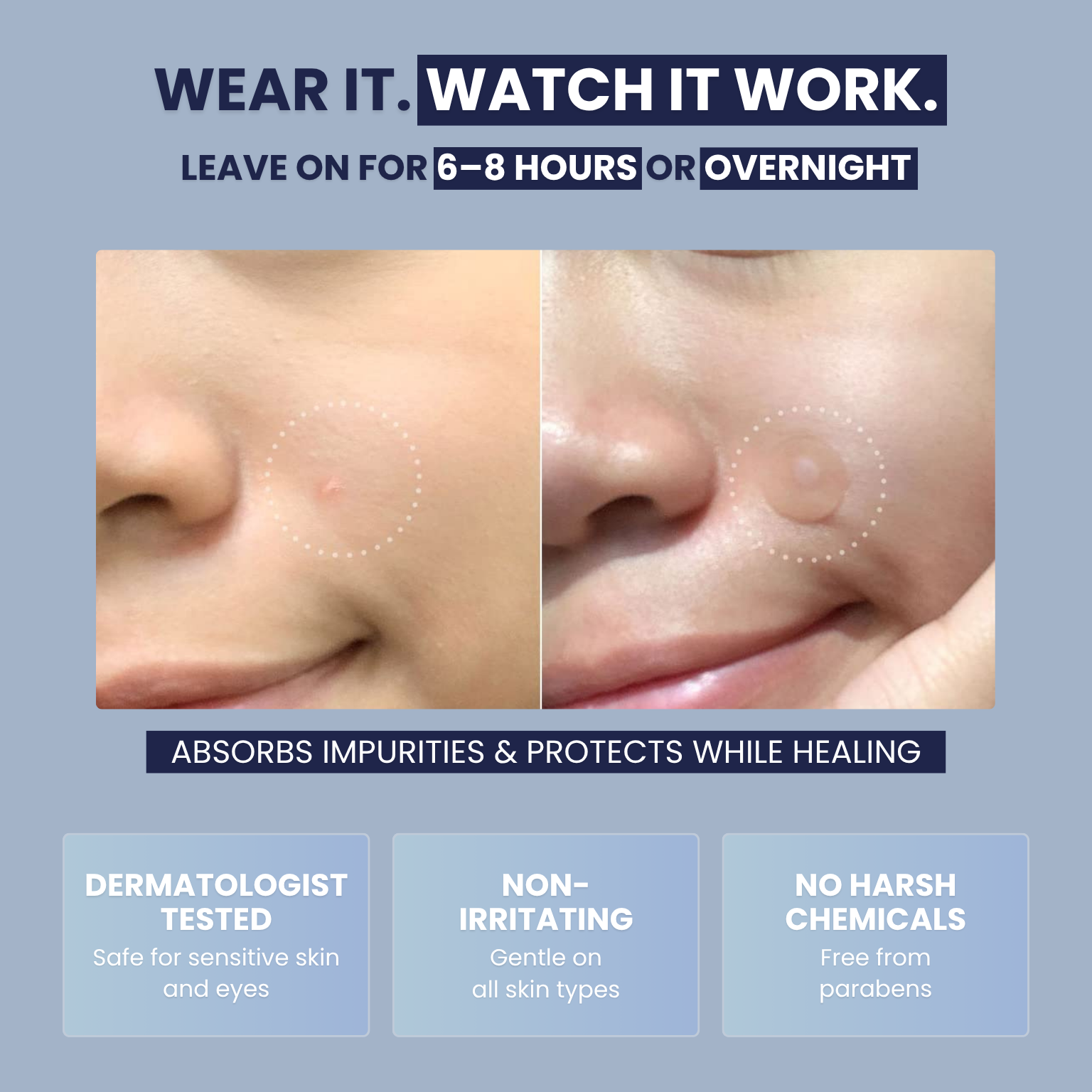 Miracle Pimple Patch