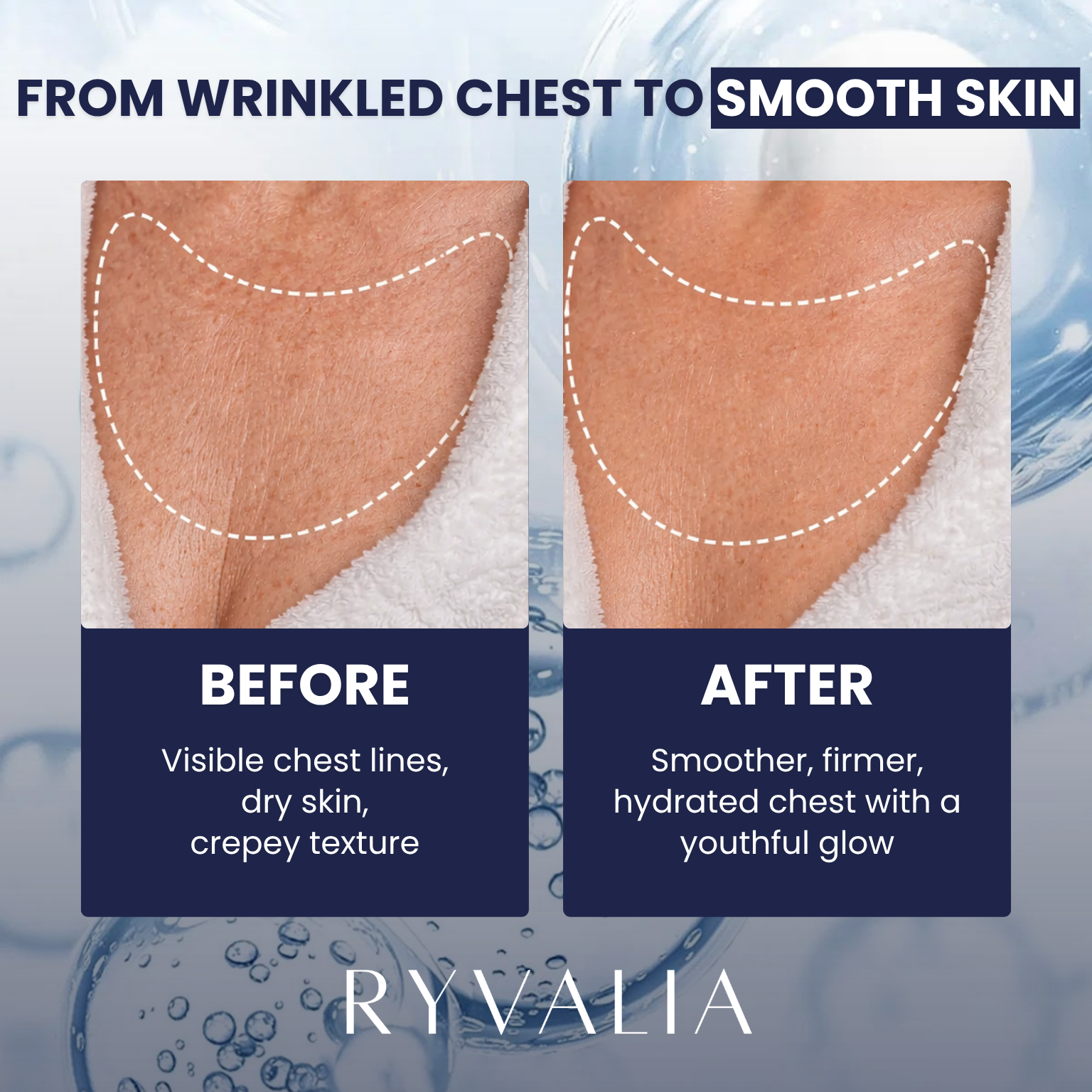 Collagen Chest Mask