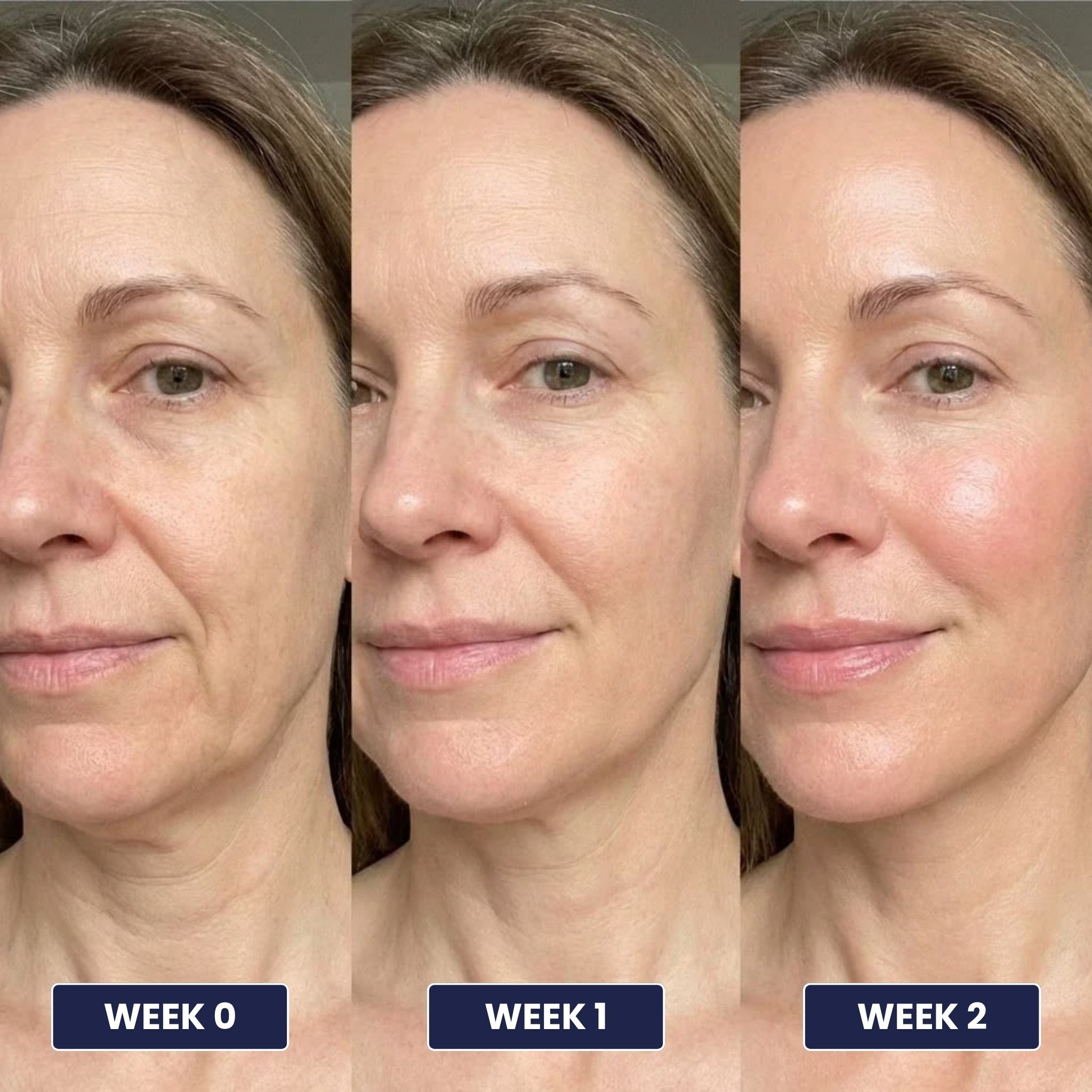 PDRN Volume Multi Balm