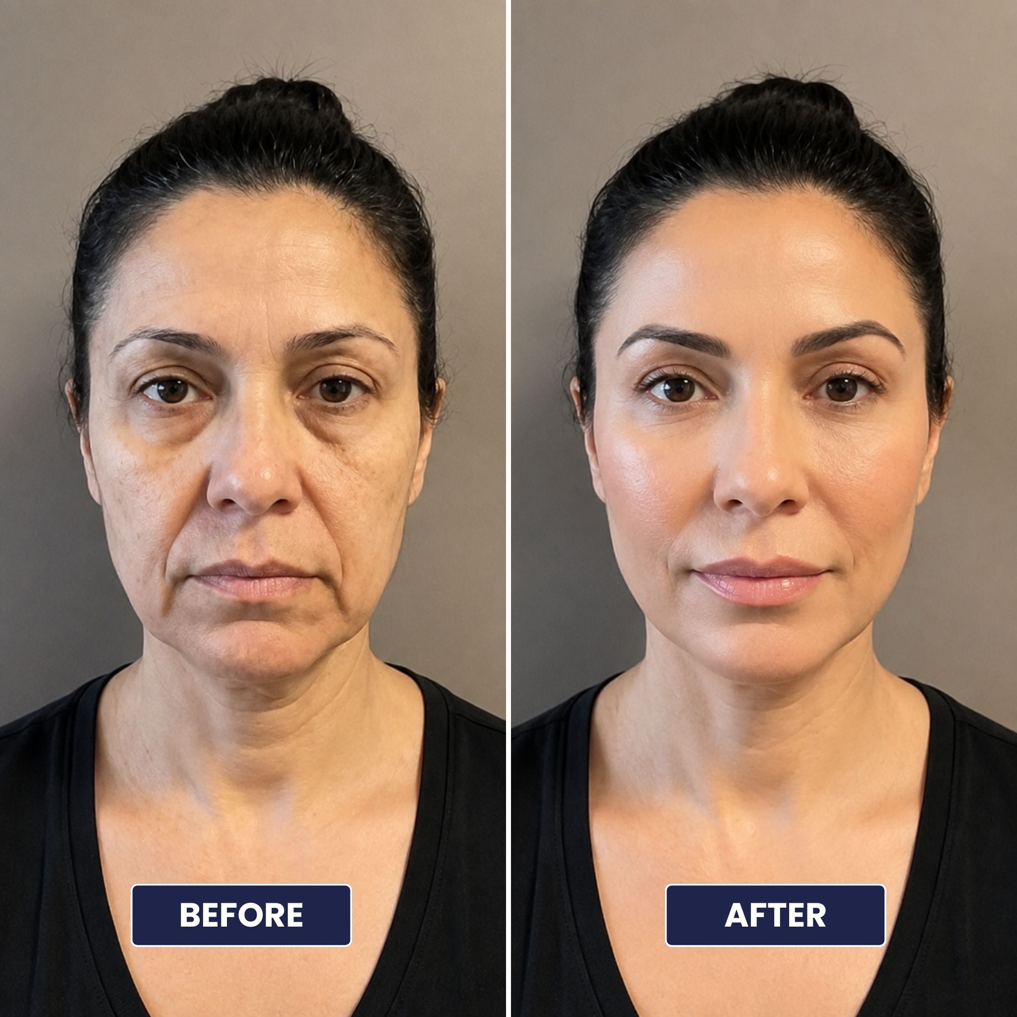 PDRN Volume Multi Balm