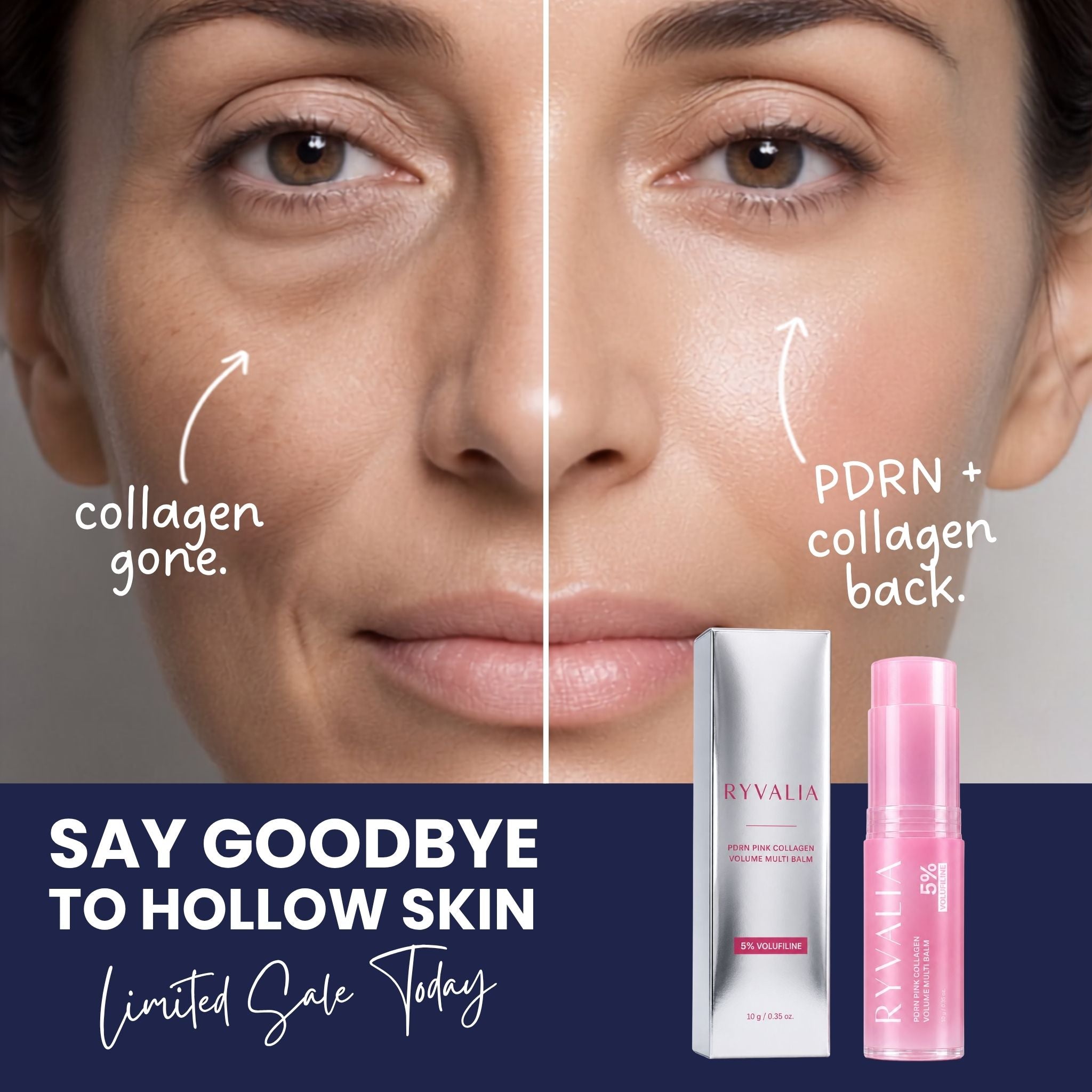 PDRN Volume Multi Balm