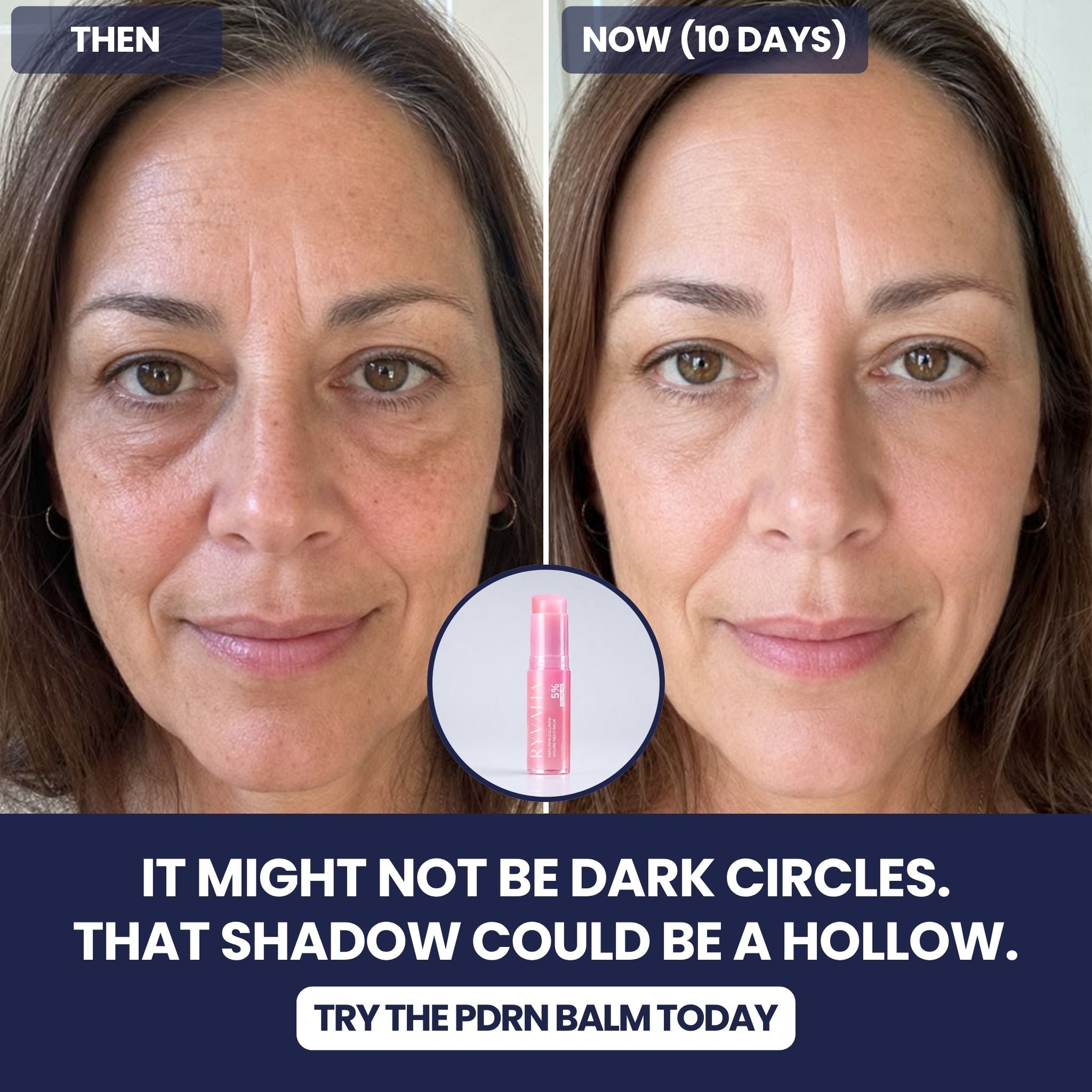 PDRN Volume Multi Balm