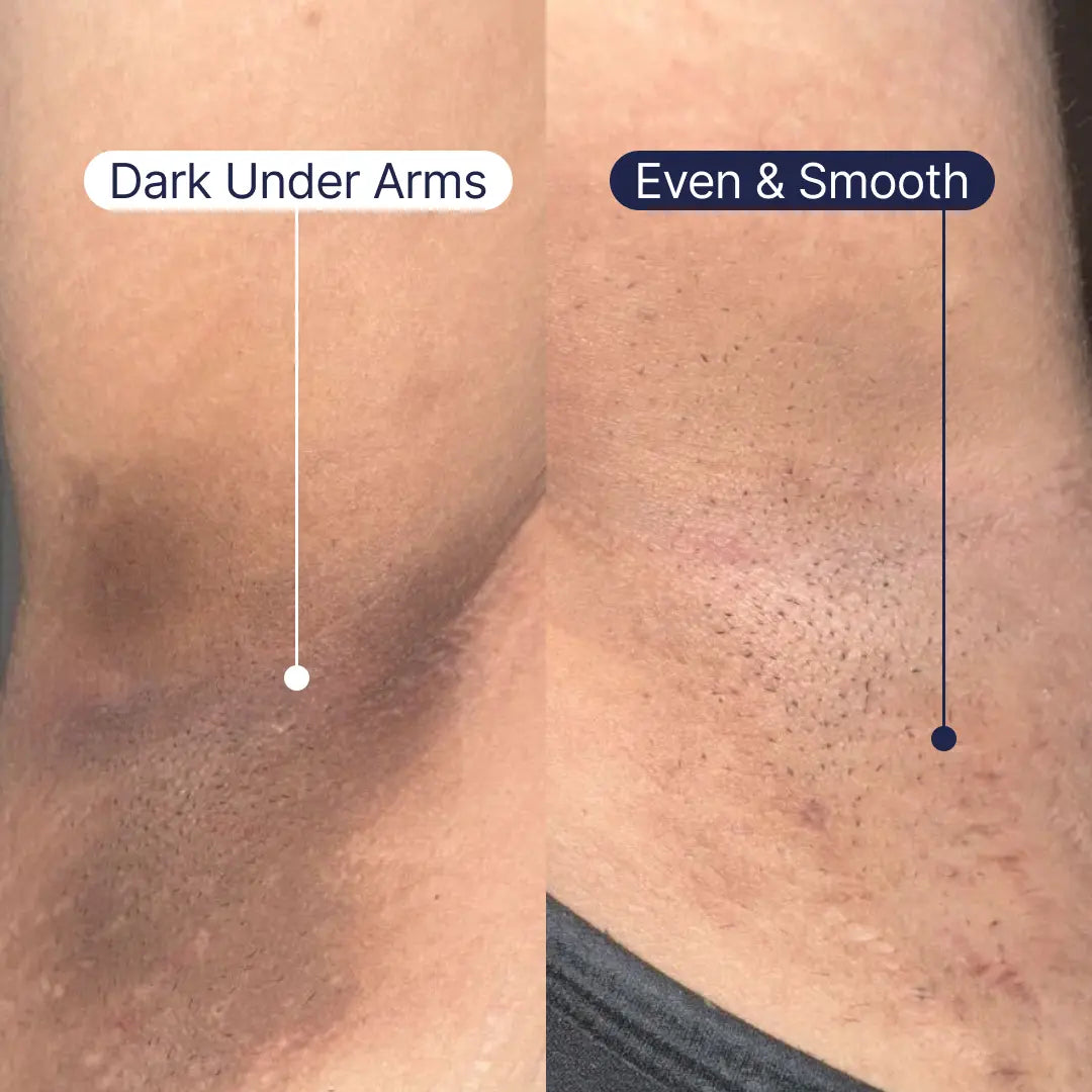 Intimate Bright Booster Serum