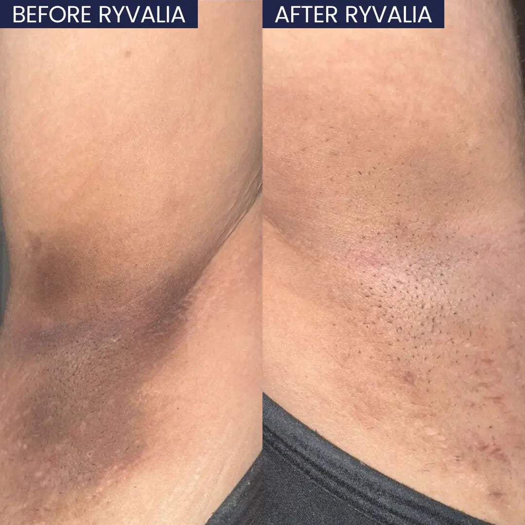 Intimate Bright Booster Serum